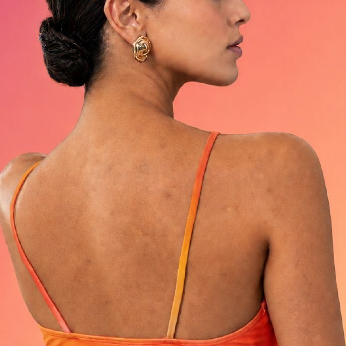Uneven Skin Tone
